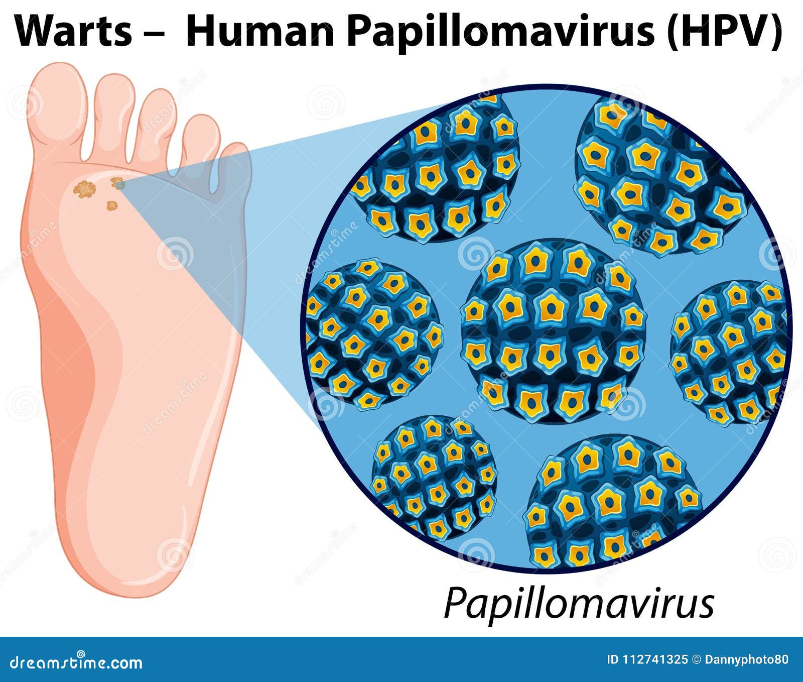 human papillomavirus diagram