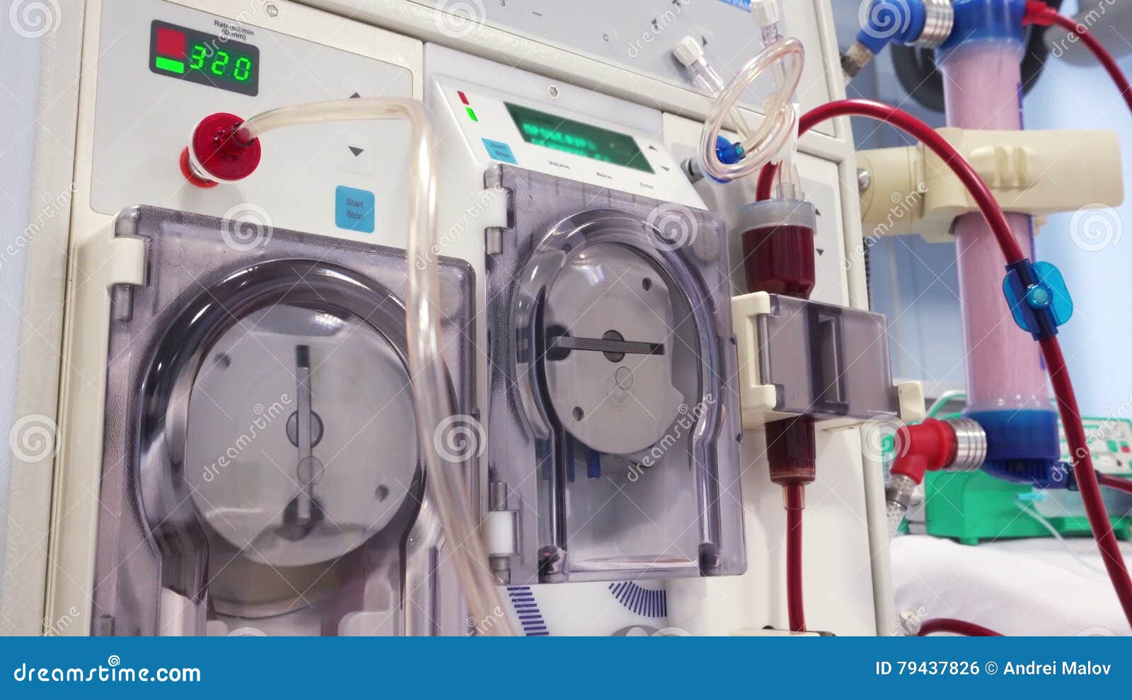 Dialysis Medical Device stock footage. Video of kidney 79437826