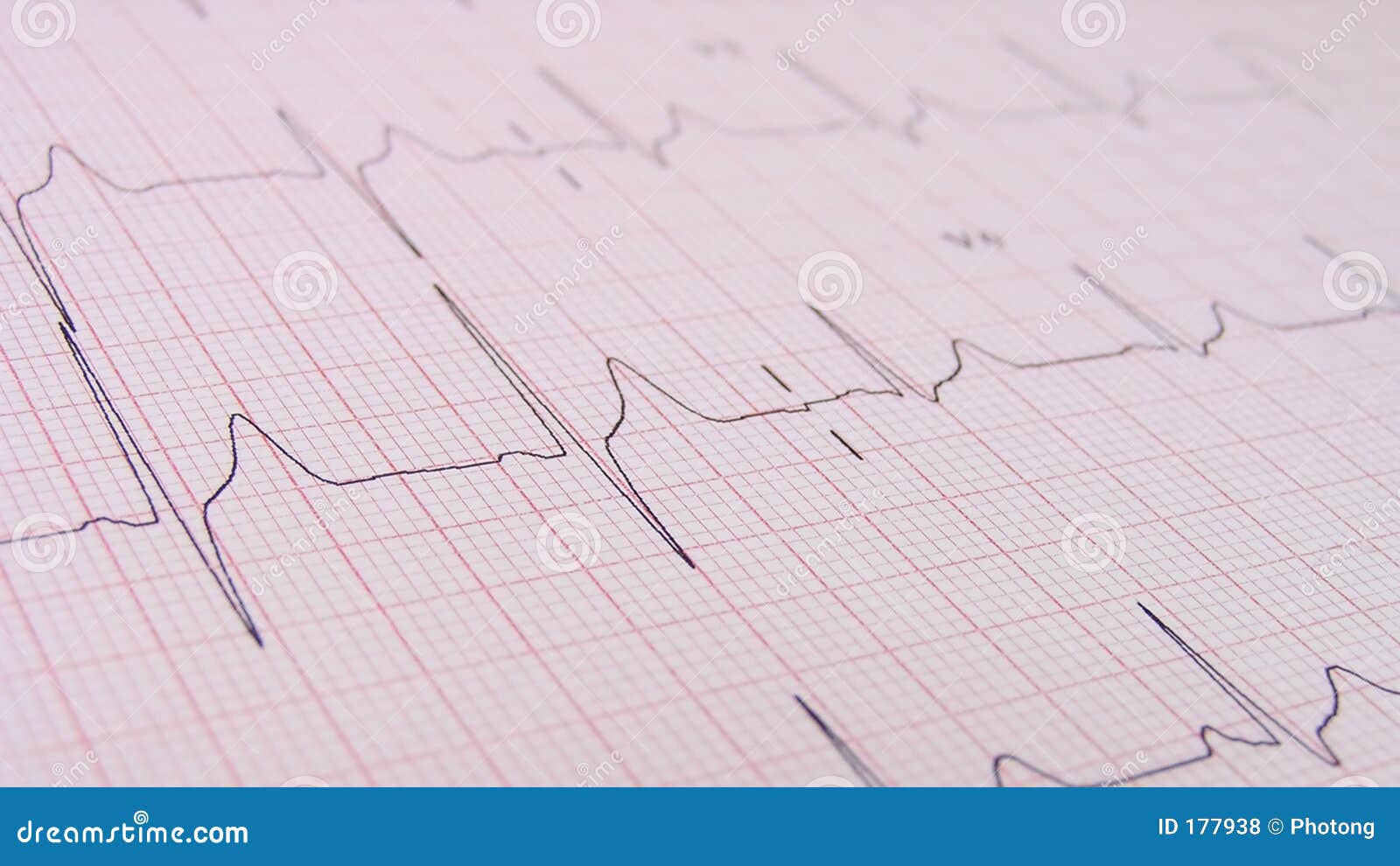 Dichte omhooggaand van Ecg. Sluit omhoog van grafiek ECG (elektrocardiograaf)