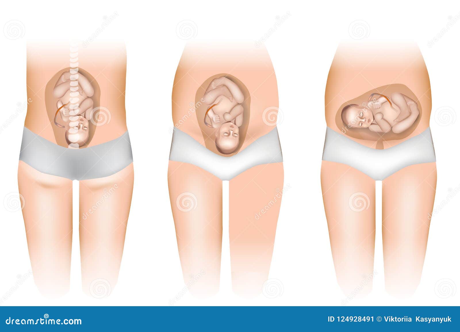 Differentes Positions De Bebe Dans L Uterus Illustration De Vecteur Illustration Du Isolement Cheri Differentes Positions De Bebe Dans L Uterus Illustration De Vecteur Illustration Du Isolement Cheri