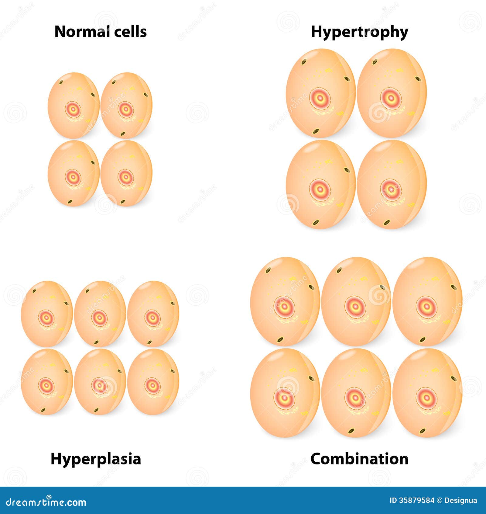 hyperplasia in plants