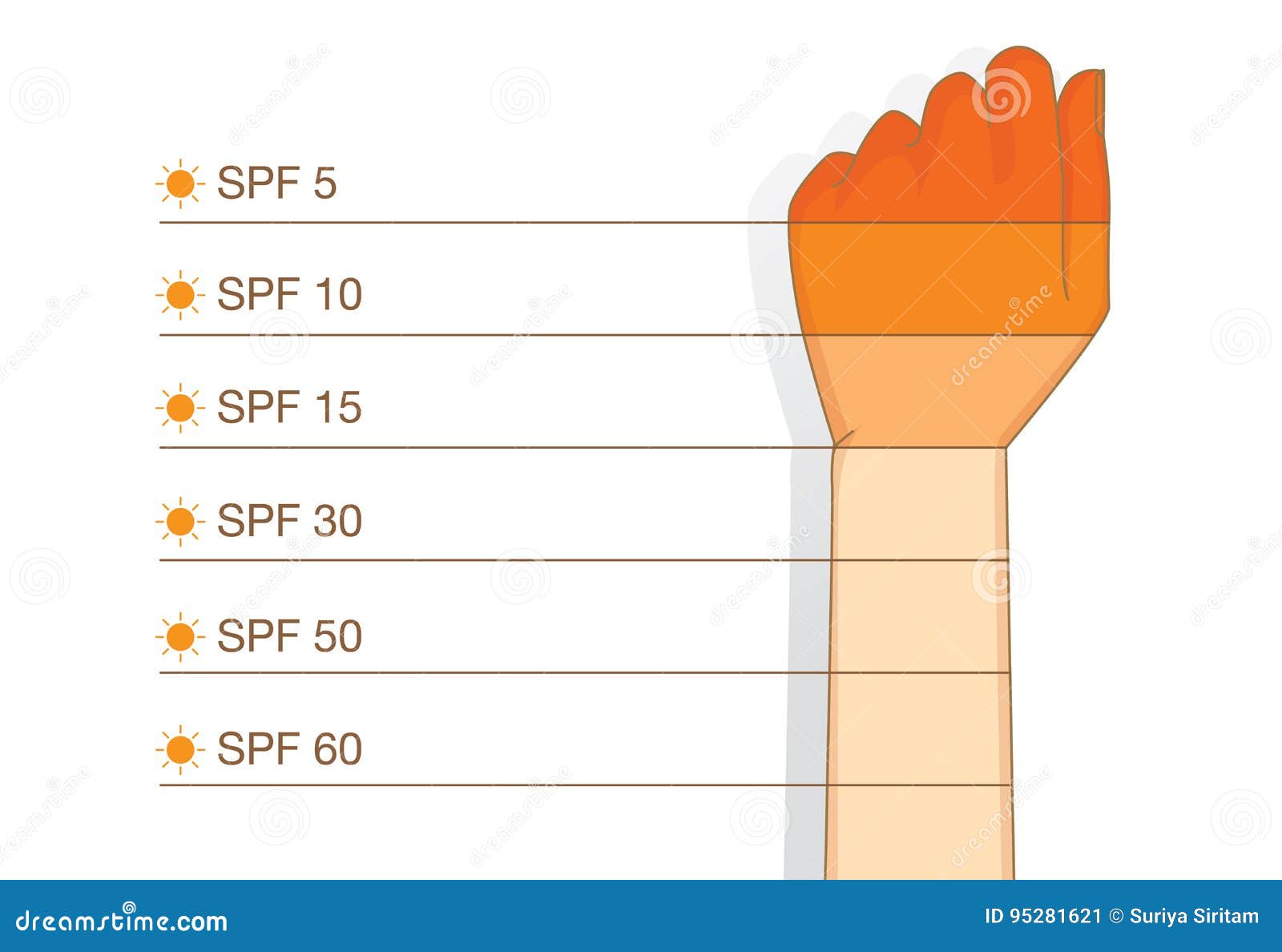 Sunburn Severity Chart