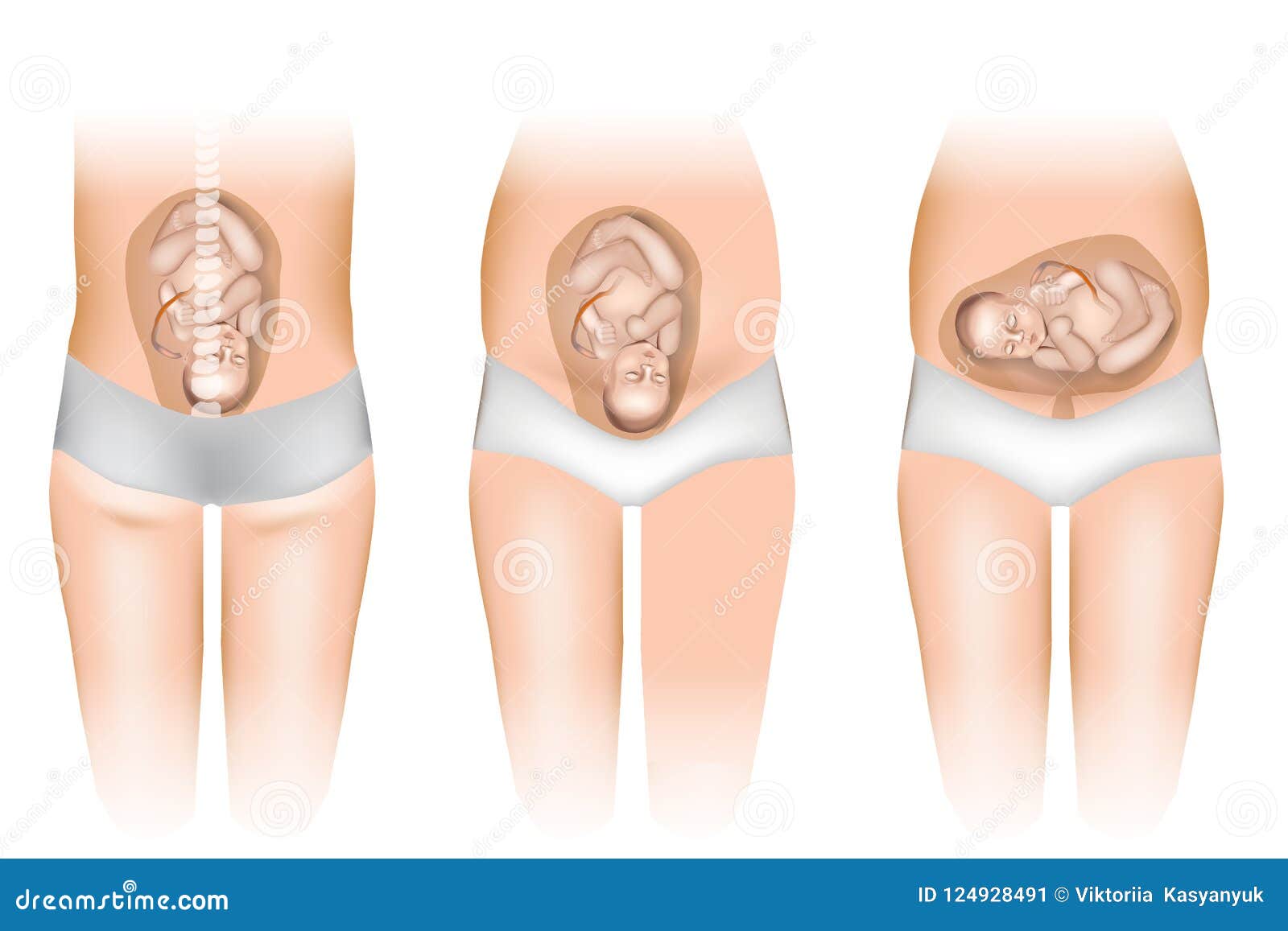 different positions of baby in the womb.