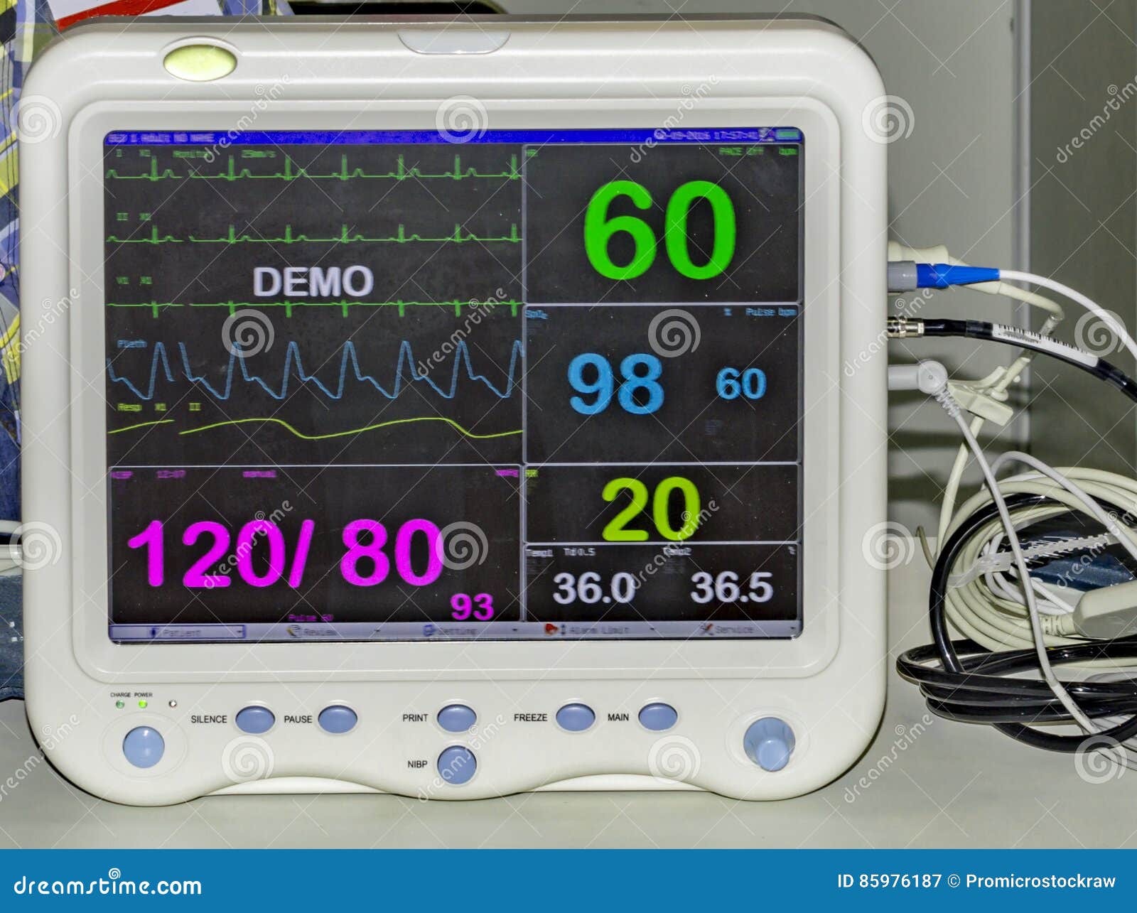 Digital cardiac monitor stock image. Image of resuscitation 85976187