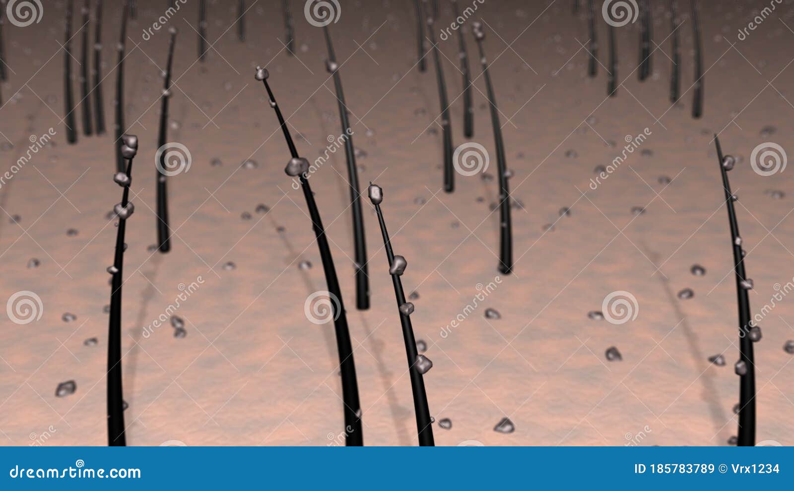 Hair on Skin, Scalp Covered with Dirt Particles, Dandruff, Debris. Close Up  Magnification. View 2. 3d Rendering Illustration Stock Illustration -  Illustration of hair, body: 185783789