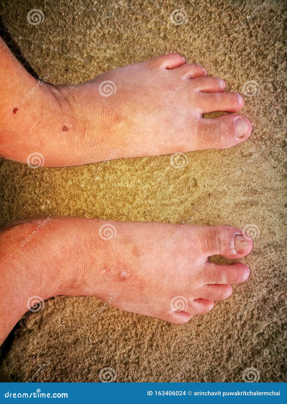 The Dirty Bare Feet on the Cement Ground. Stock Photo - Image of bare