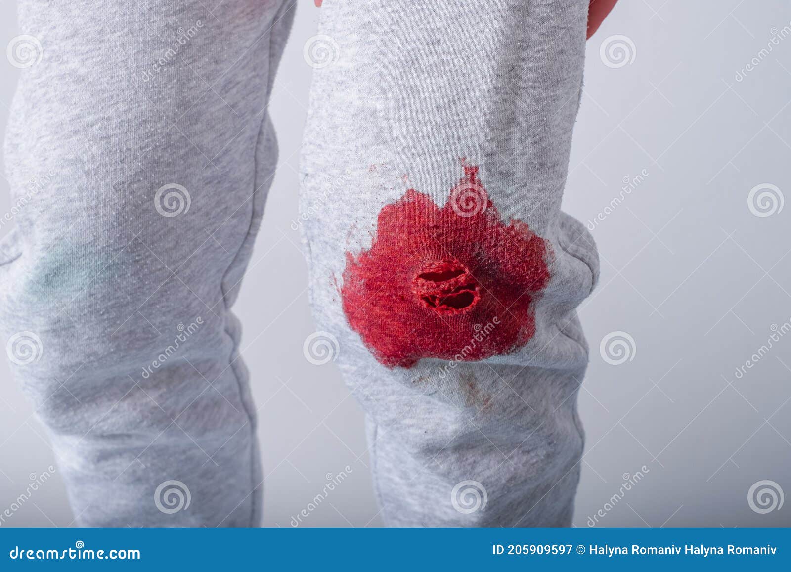 Dirty Blood Stain on Children`s Clothes. daily Life Dirty Stain for