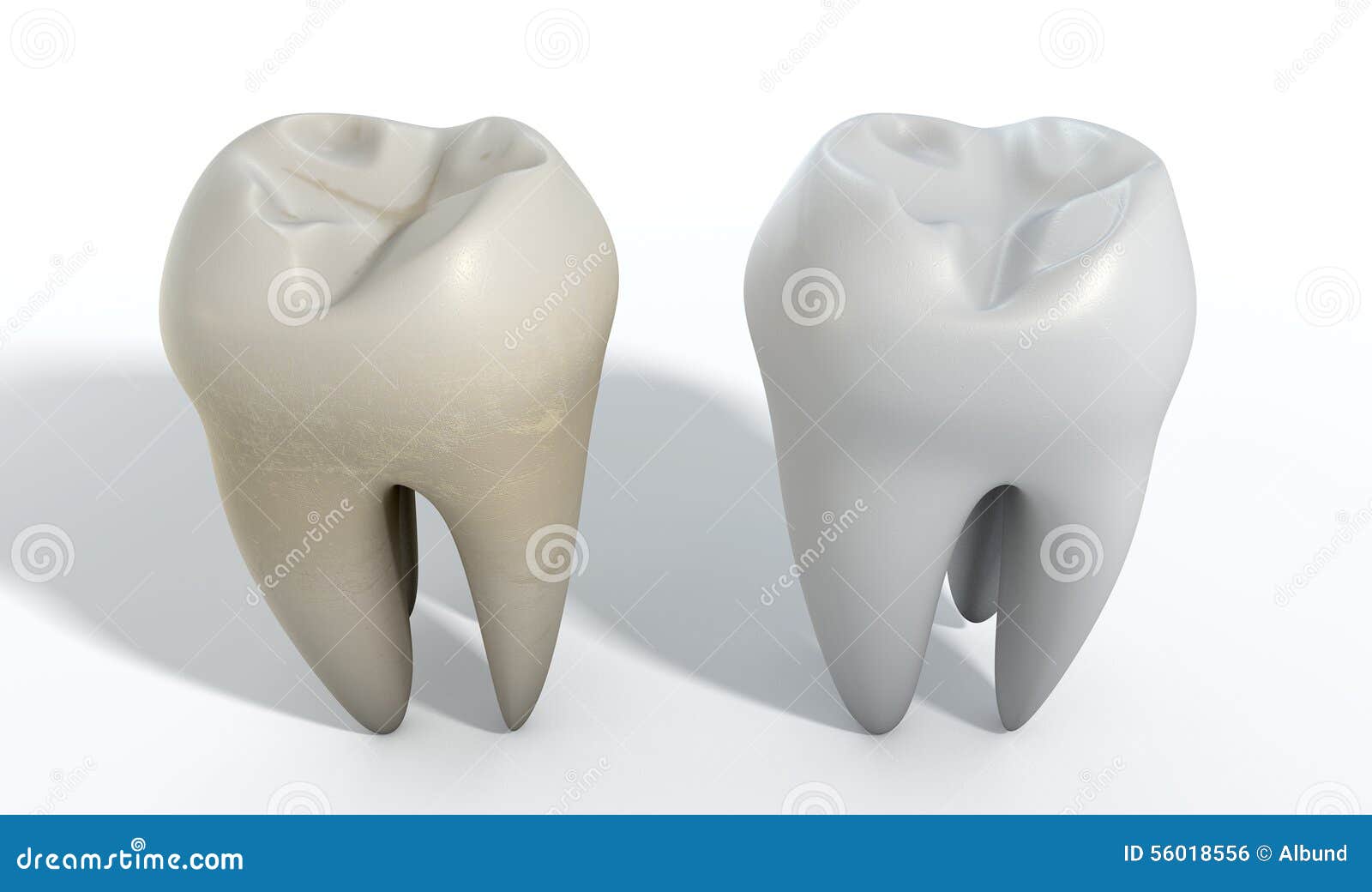 Dirty Clean Tooth Comparison Stock Photo Image of orthodontics, dentist 56018556