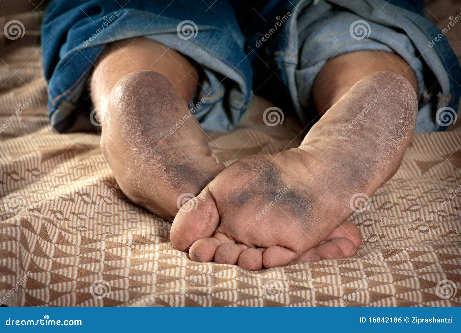 5,500+ Ugly Feet Stock Photos, Pictures & Royalty-Free Images - iStock