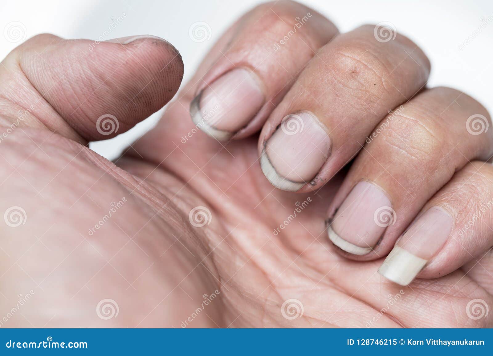 dirty finger nails unhealthy pile up germ and bacteria unclean