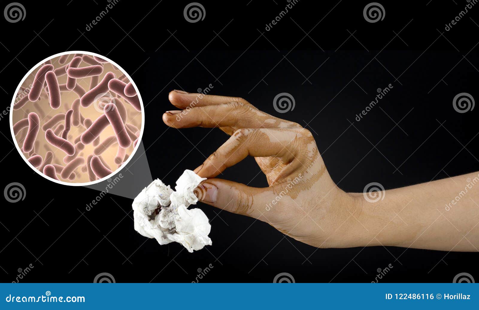 Dirty hand stock photo. Image of disinfect, medical 122486116