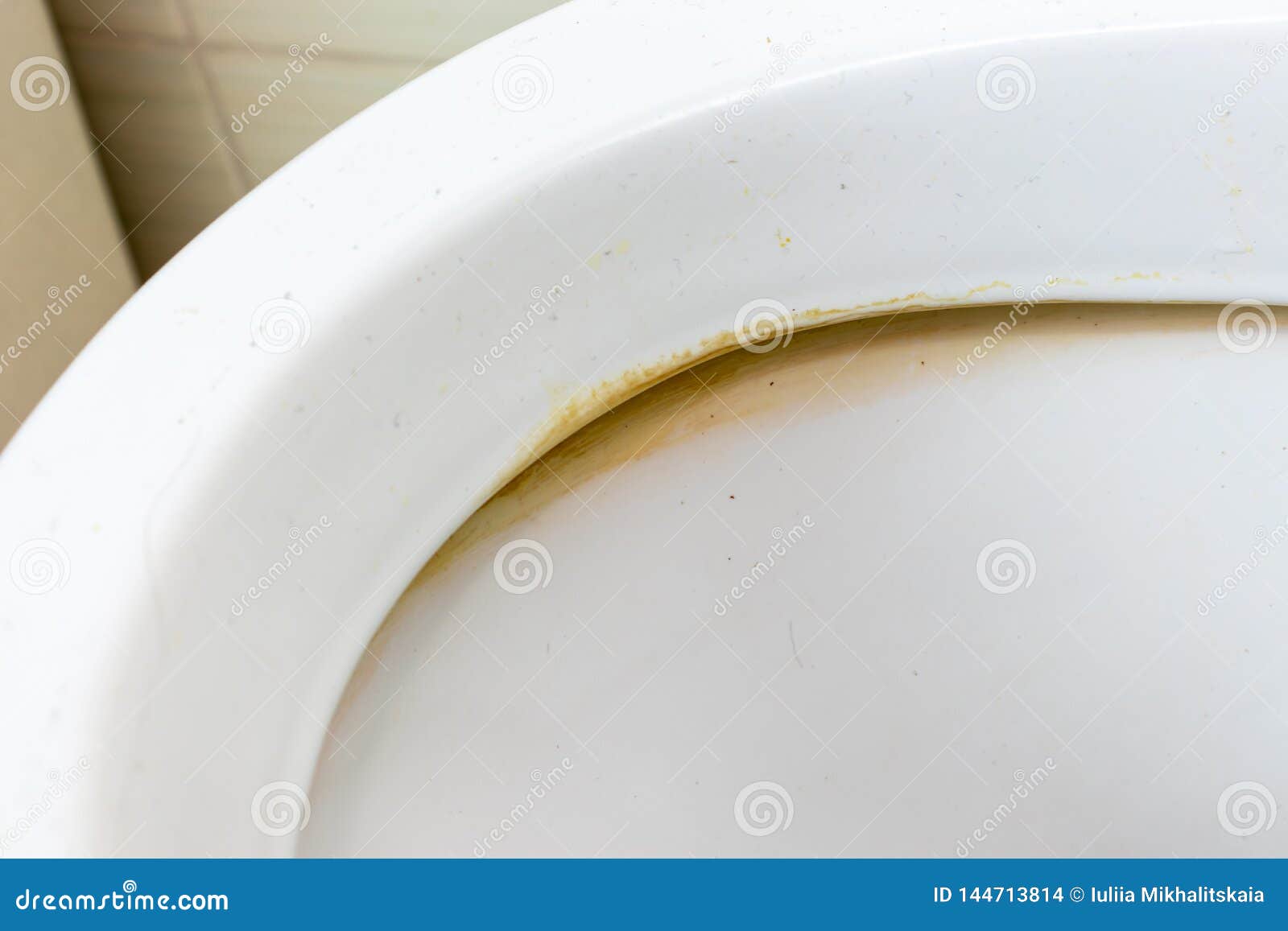 Dirty Unhygienic Toilet Rim with Limescale and Rust Stain at