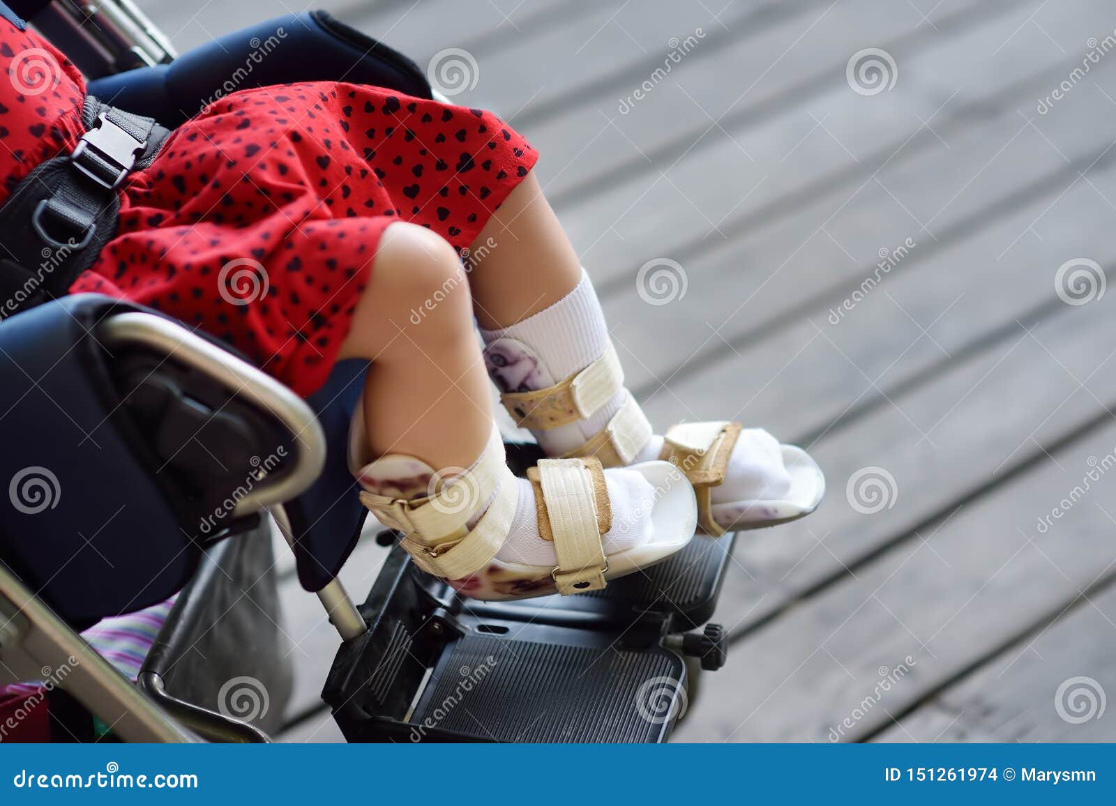 disabled girl sitting in wheelchair. on her legs orthosis. child cerebral palsy. inclusion