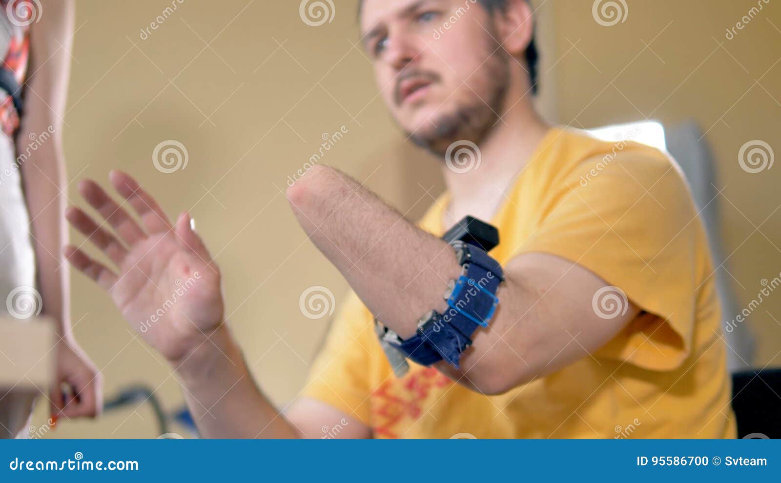 Disabled Man with the Amputated Arm. Wireless Sensor for Bionic