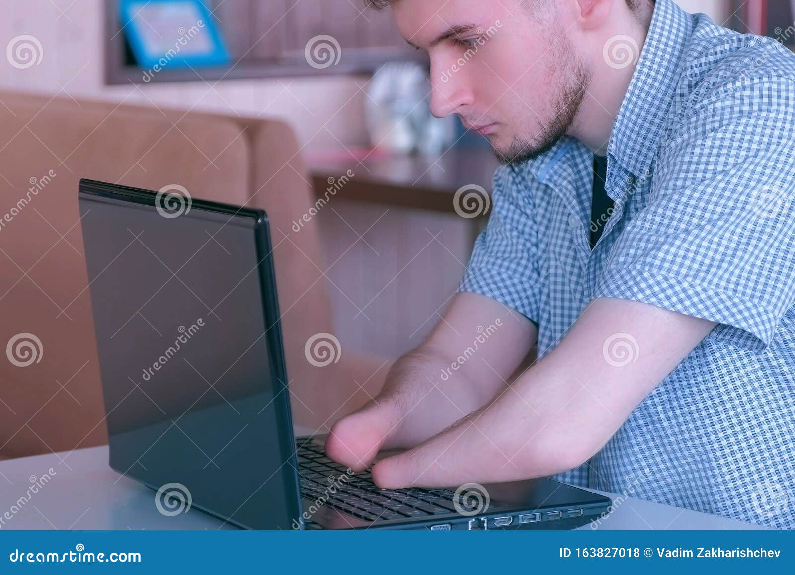 disabled-man-amputated-two-stump-hands-typing-working-laptop-cafe-portrait-disabled-man-amputated-two-stump-163827018.jpg