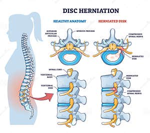 Illustration Of The Vertebral Colum Stock Photography CartoonDealer 