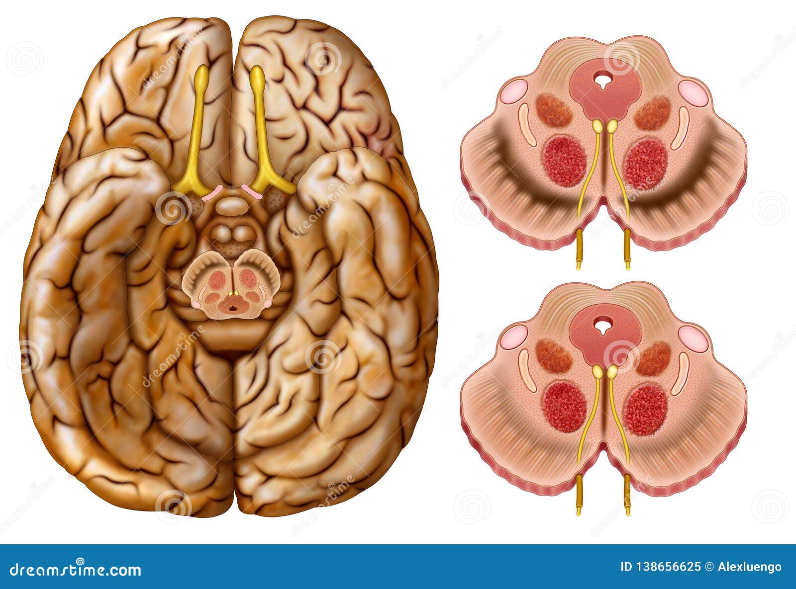 disminuciÃÂ³n de la dopamina en la enfermedad de parkinson