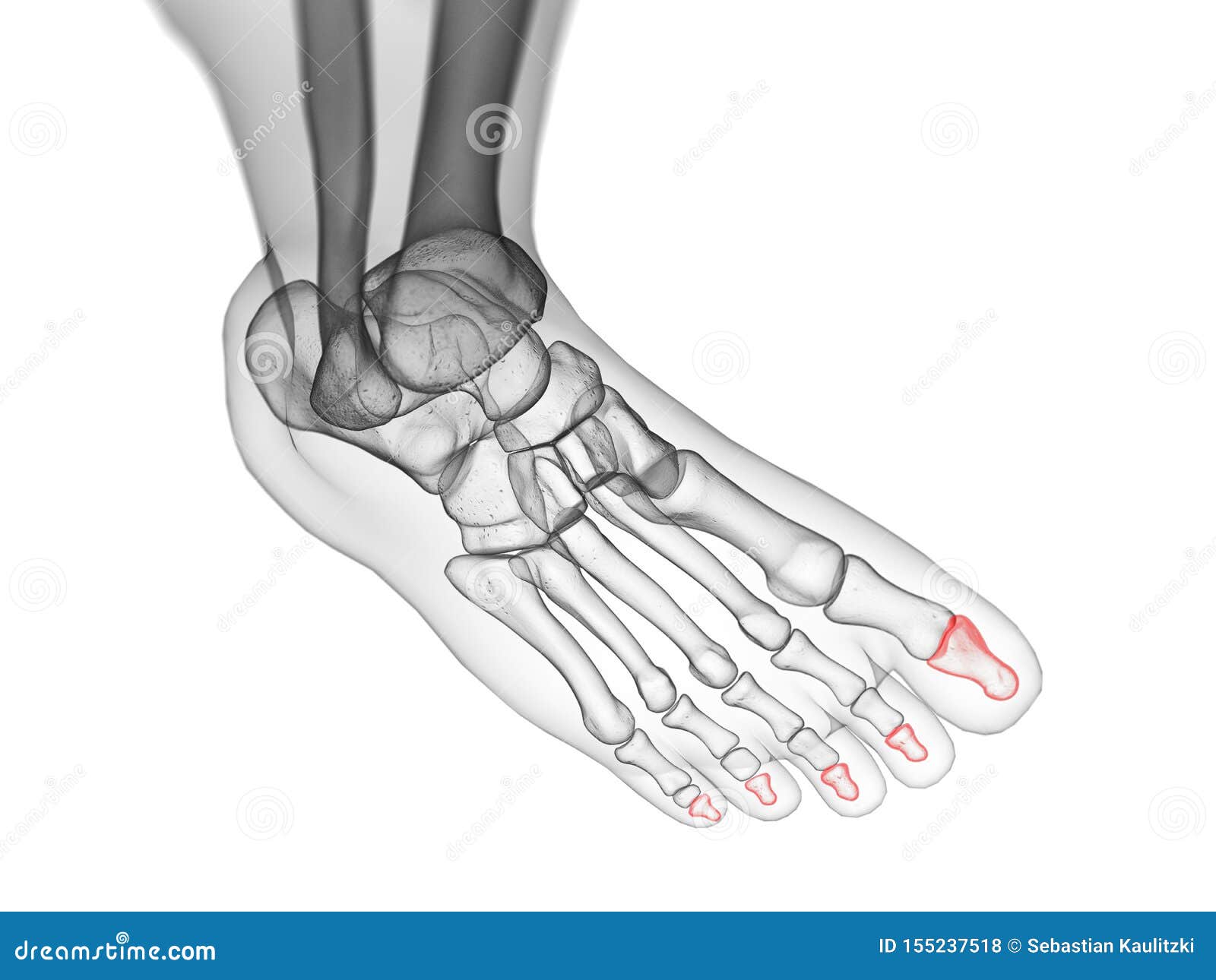 the distal phalanx bones