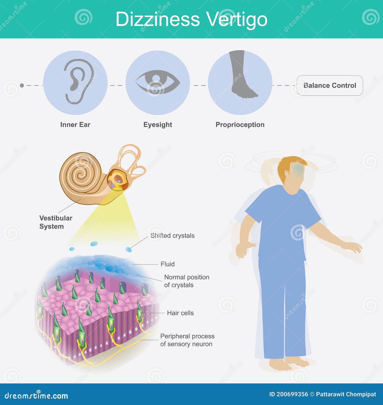 dizziness vertigo.  explain dizziness