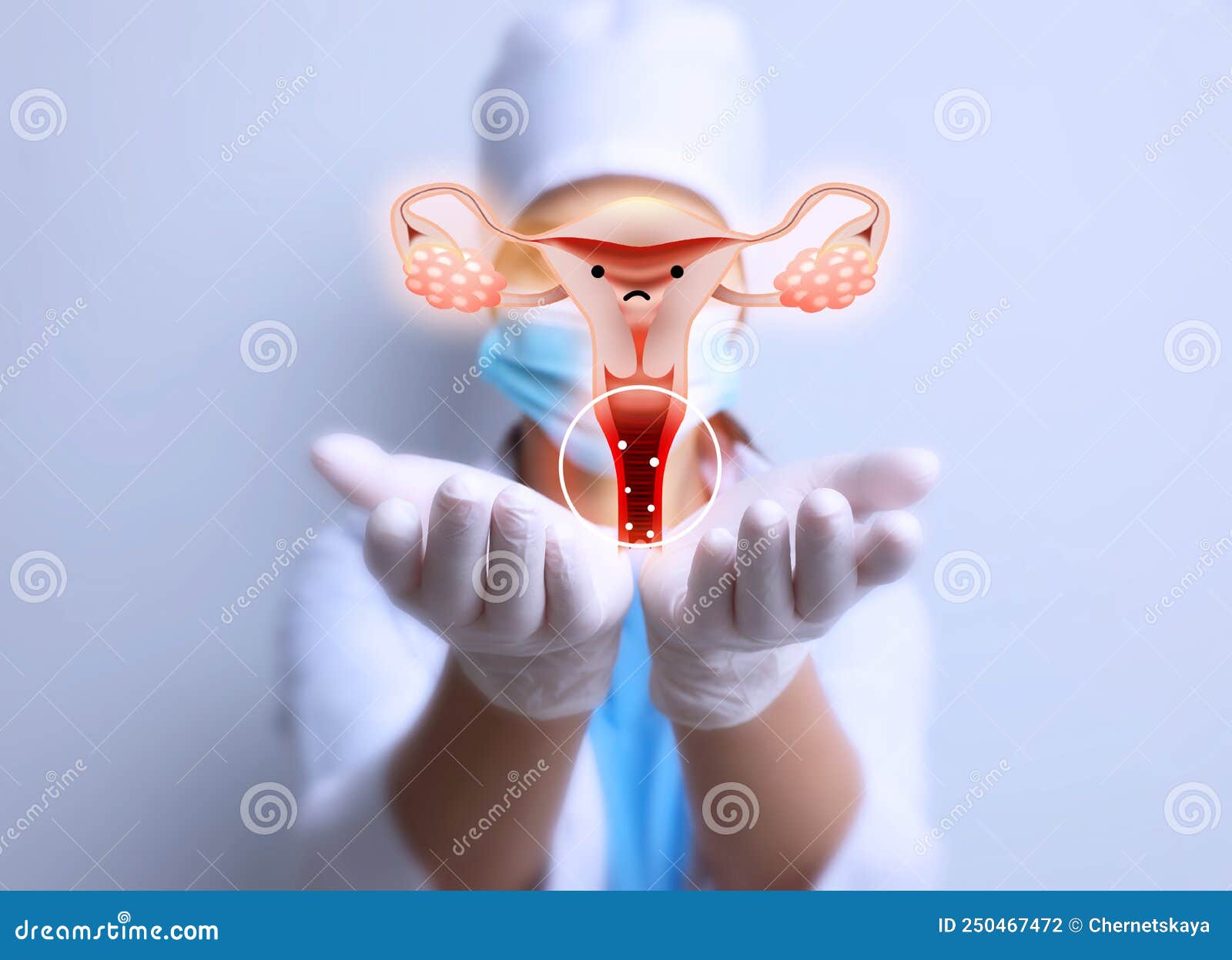 doctor demonstrating virtual image of infected female reproductive system on light background, closeup. vaginal candidiasis