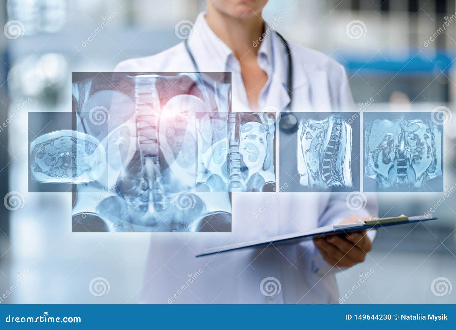The Doctor Examines Resonance Imaging Stock Photo Image of