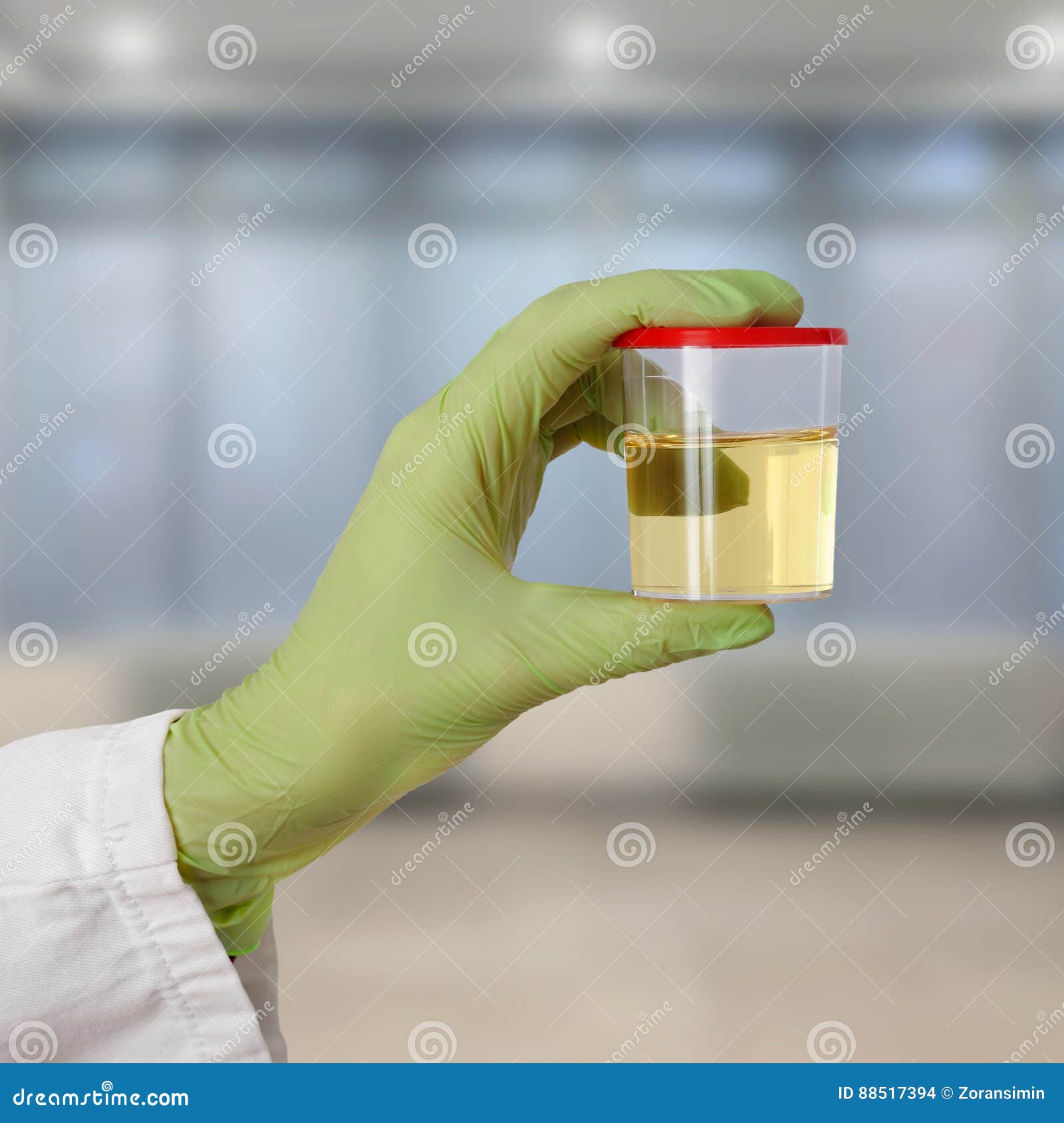 Doctor hold urine sample stock photo. Image of analysis 88517394