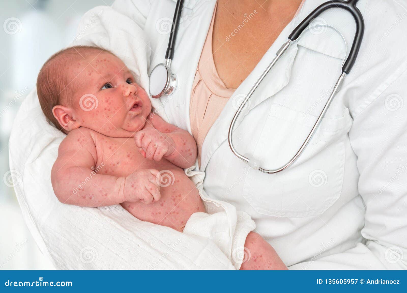 doctor holding a newborn baby which is sick rubella or measles