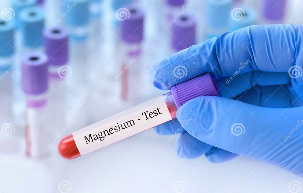Doctor Holding a Test Blood Sample Tube with Magnesium Test on the
