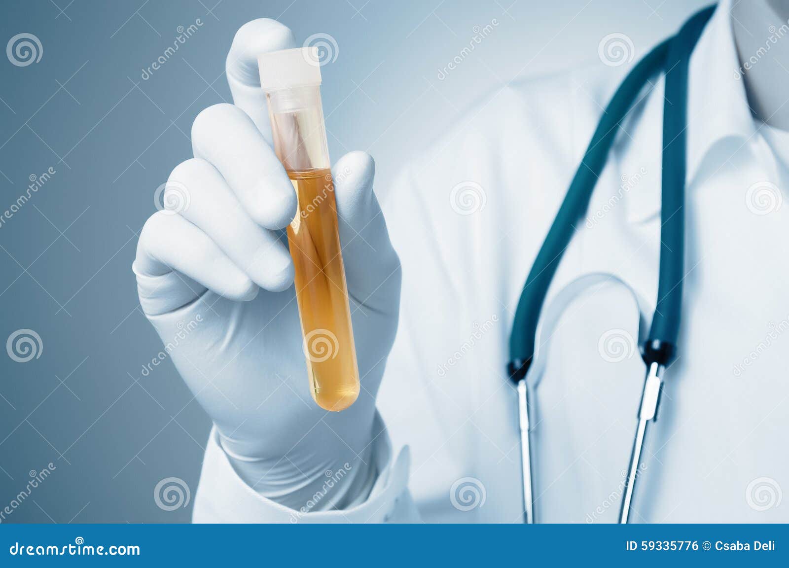 doctor holding urine sample