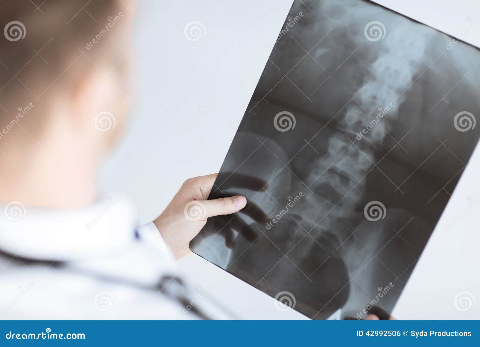 doctor holding x-ray or roentgen image