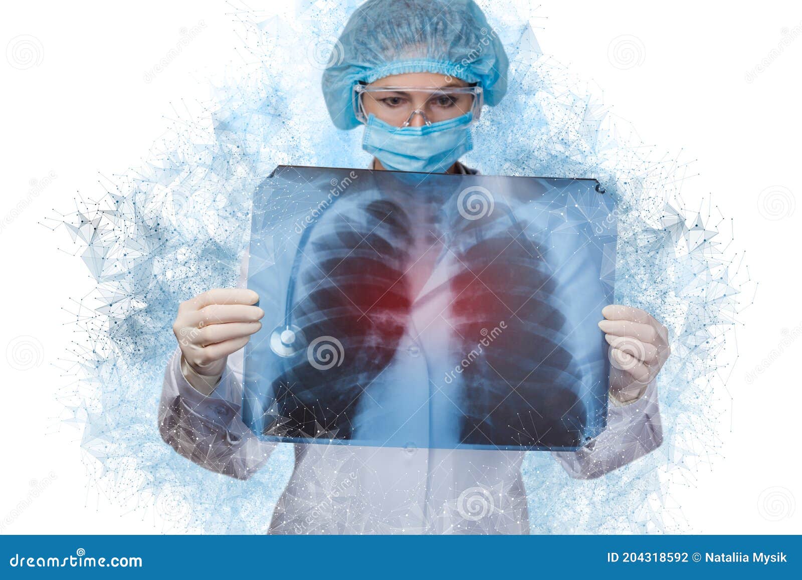 doctor looking at a snapshot of lungs with pneumonia