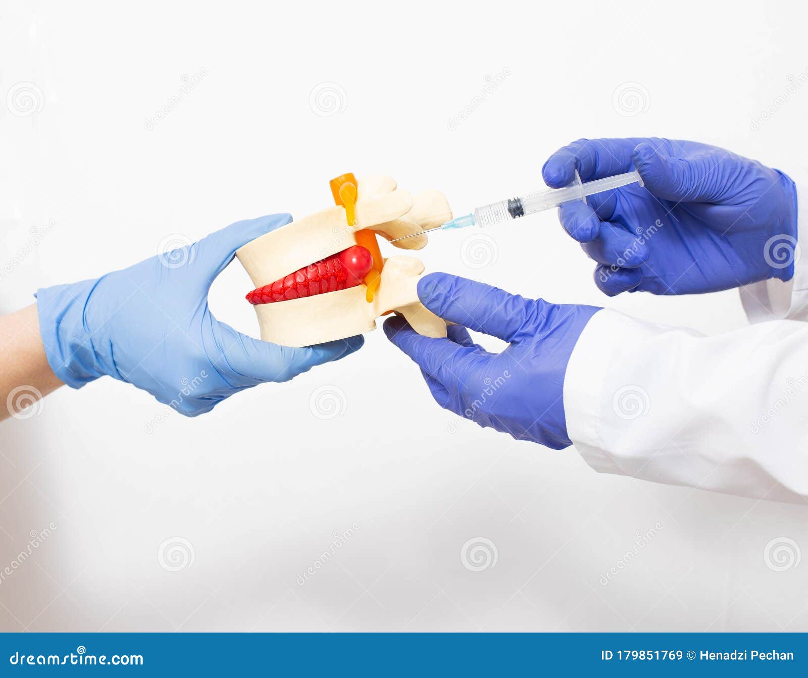 doctor neurologist holds a mock spine with intervertebral hernia. the doctor makes the paravertebral block into a hernia of the