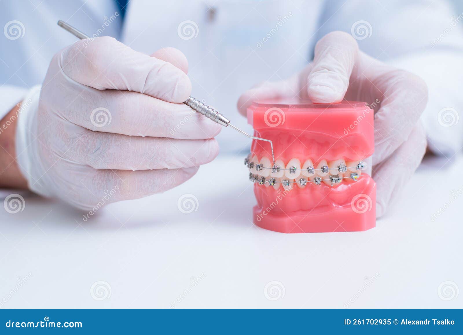 Doctor Orthodontist Shows How the System of Braces on Teeth is Arranged