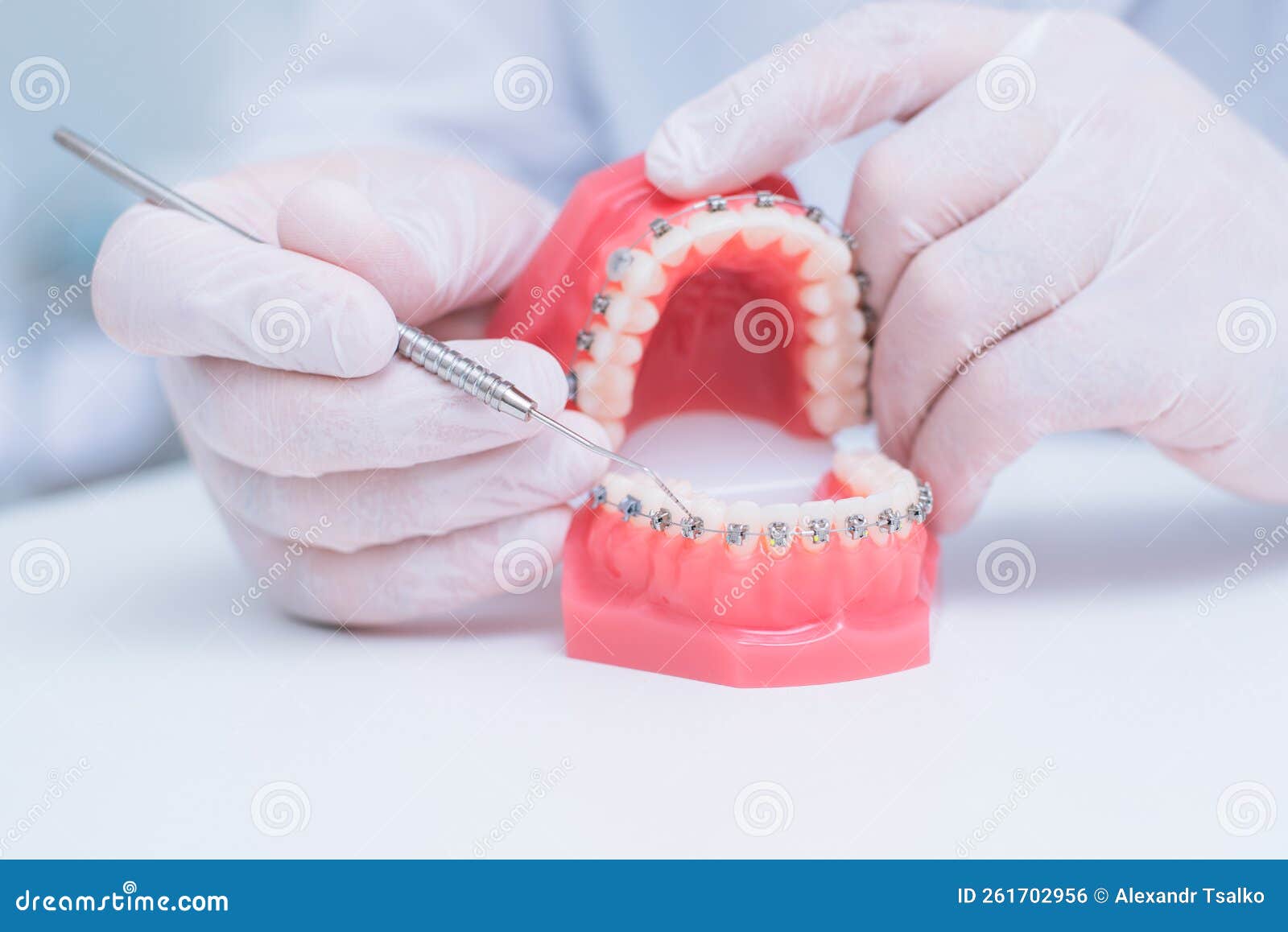Doctor Orthodontist Shows How the System of Braces on Teeth is Arranged