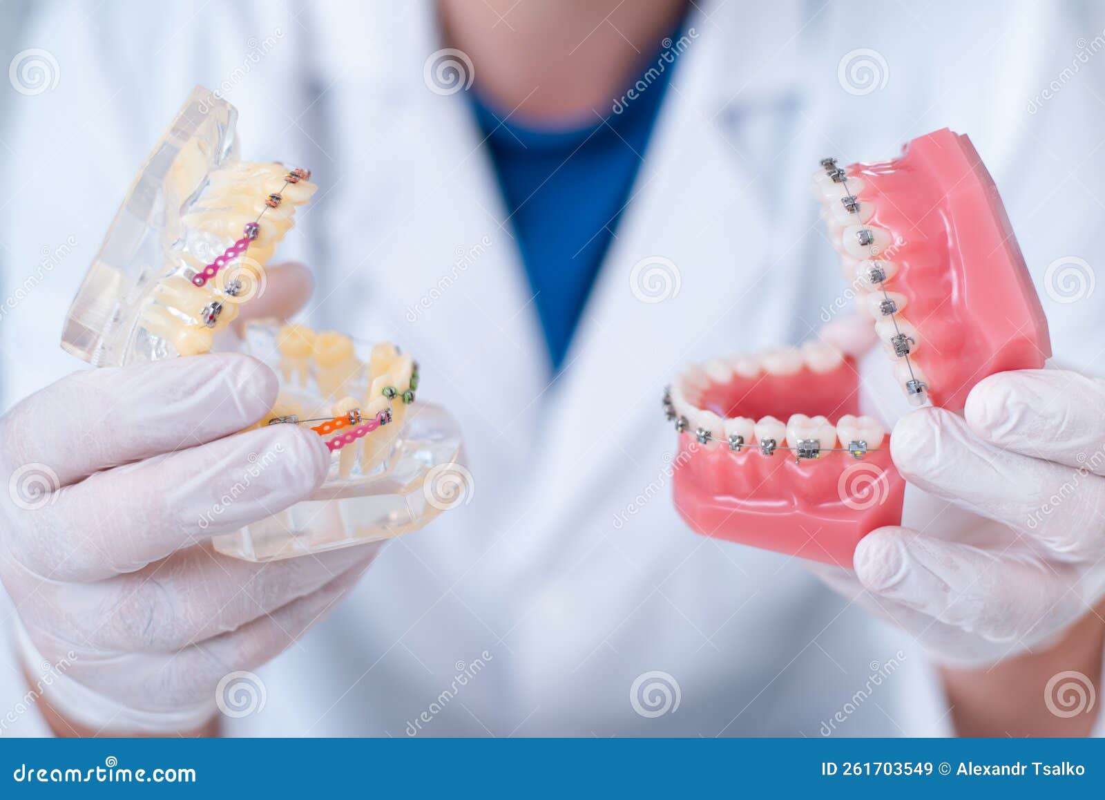 Doctor Orthodontist Shows How the System of Braces on Teeth is Arranged