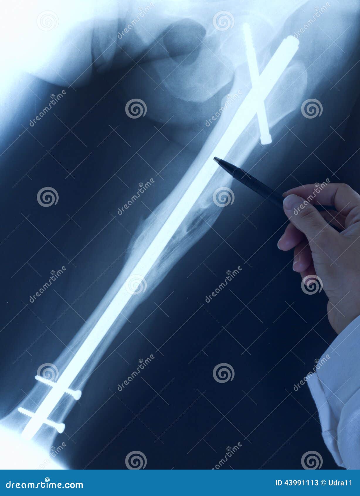 doctor orthopedist examine x-ray