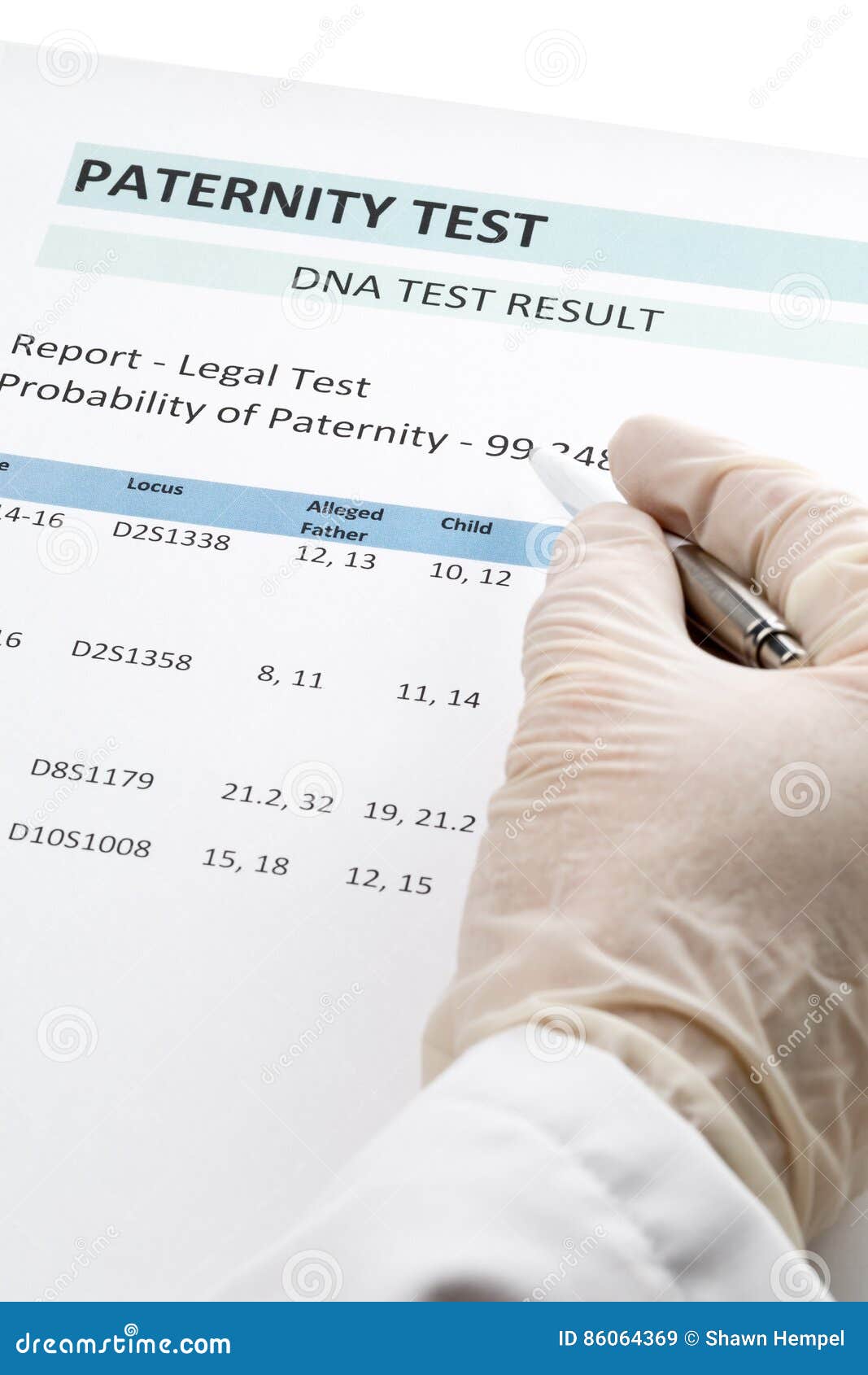 doctor points at result on paternity test result form