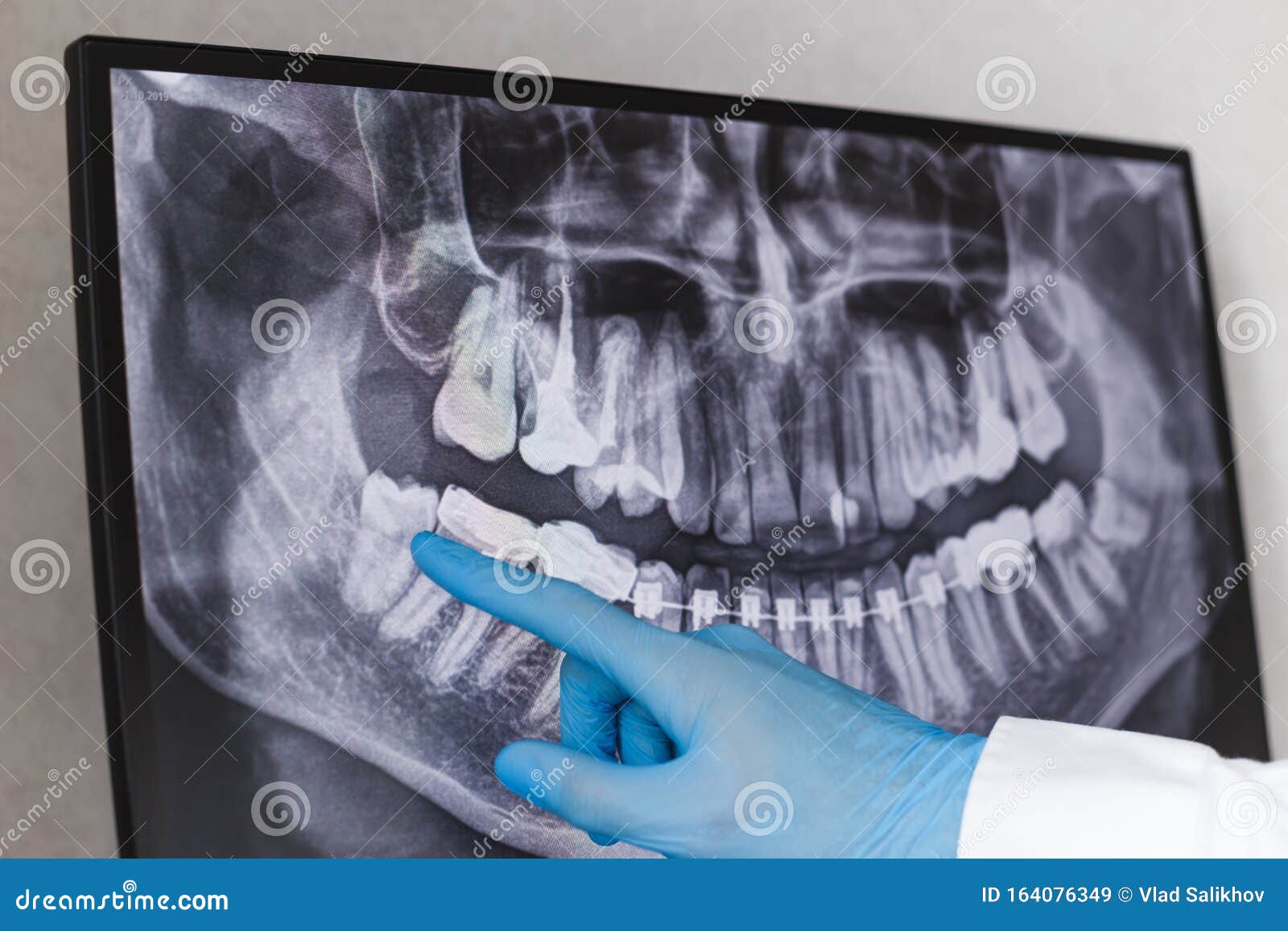 Wisdom Tooth Background Images, HD Pictures and Wallpaper For Free