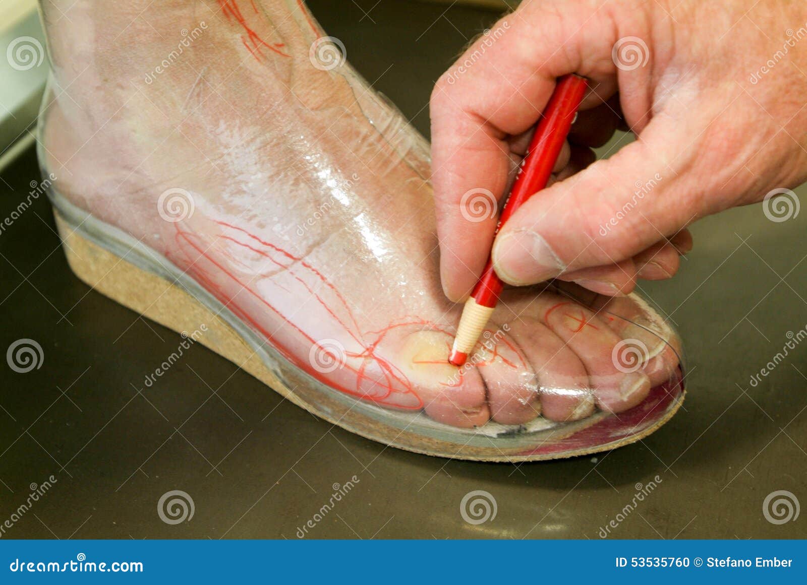 Doctor Preparing Orthopedic Insoles for a Patient Stock Photo Image