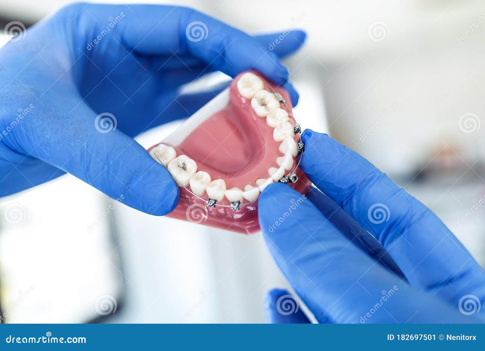 the doctorÃ¢â¬â¢s hands in blue gloves hold an artificial model of the jaw with breaks. the dentist shows an example of tooth