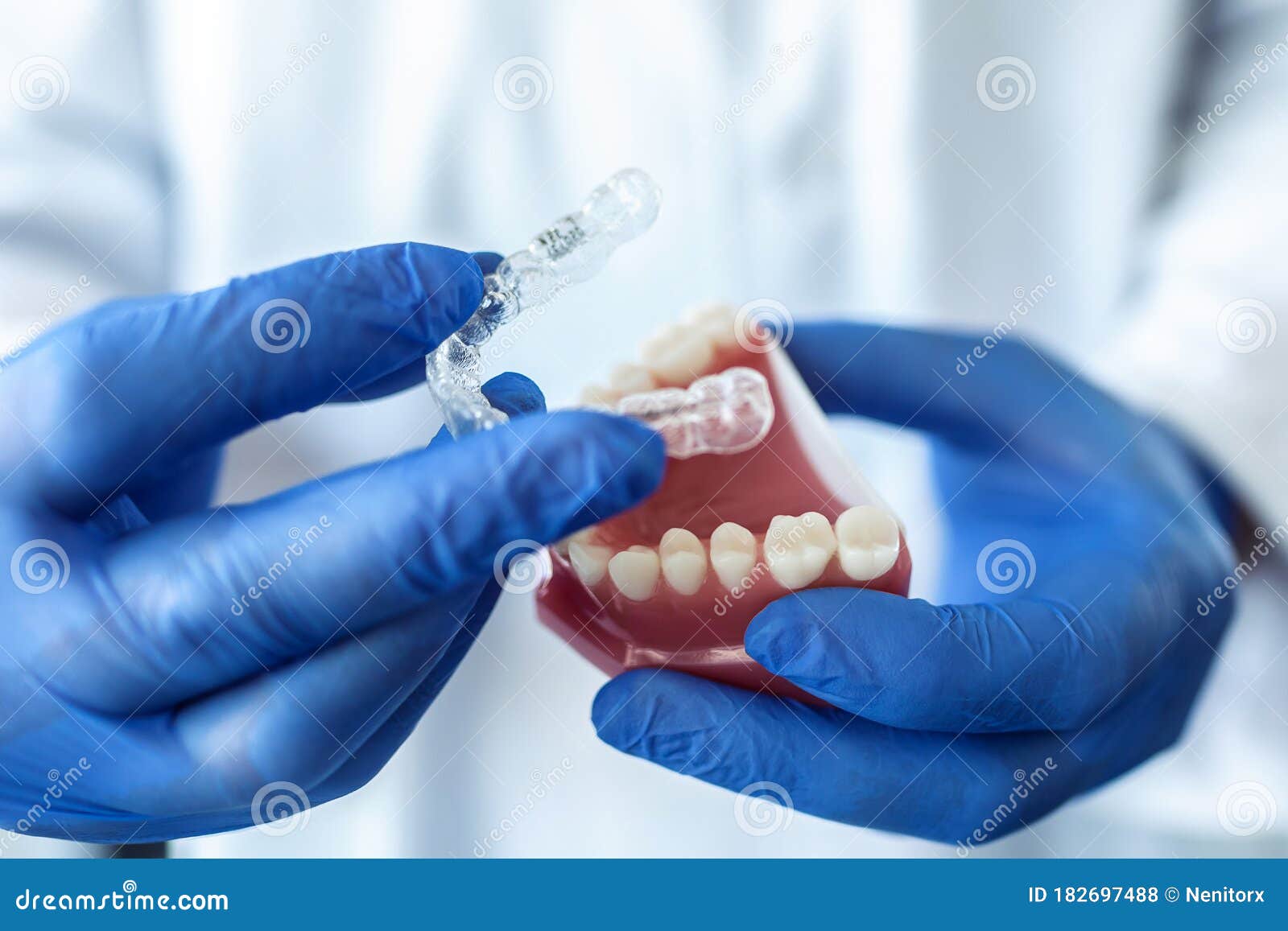 the doctorÃ¢â¬â¢s hands in blue gloves hold an artificial model of the jaw with invisible braces. the dentist shows an example of