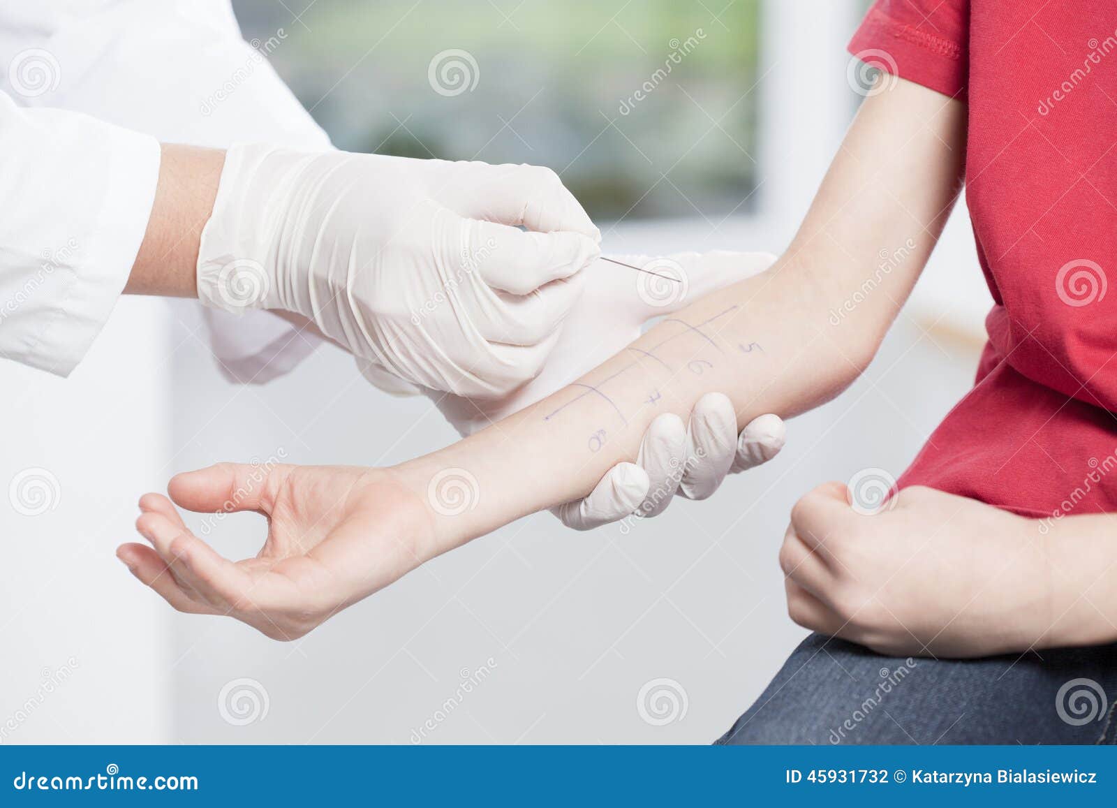 doctor's hands doing allergy test