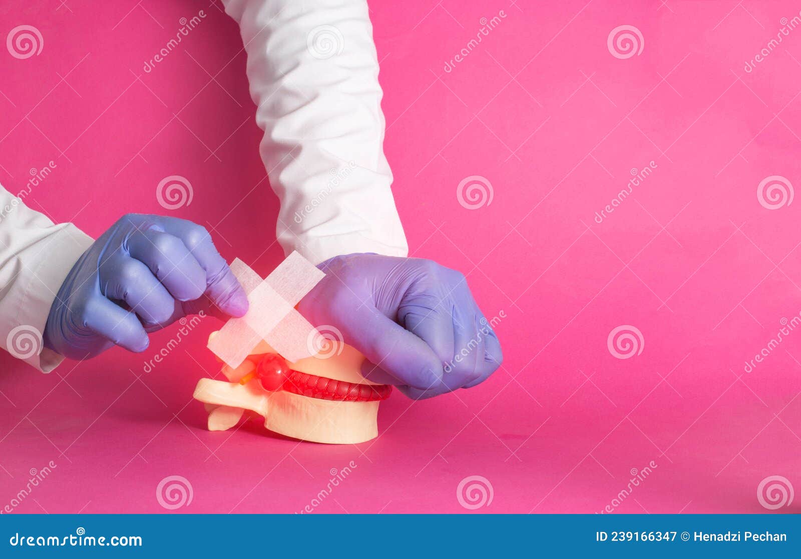 the doctor`s hands are gluing a medical plaster on the released nucleus pulposus, intervertebral hernia, pink background.