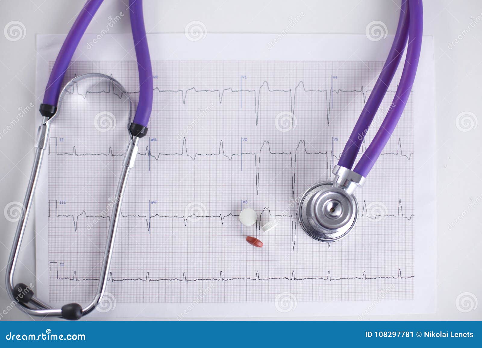 How To Read Cardiogram Chart