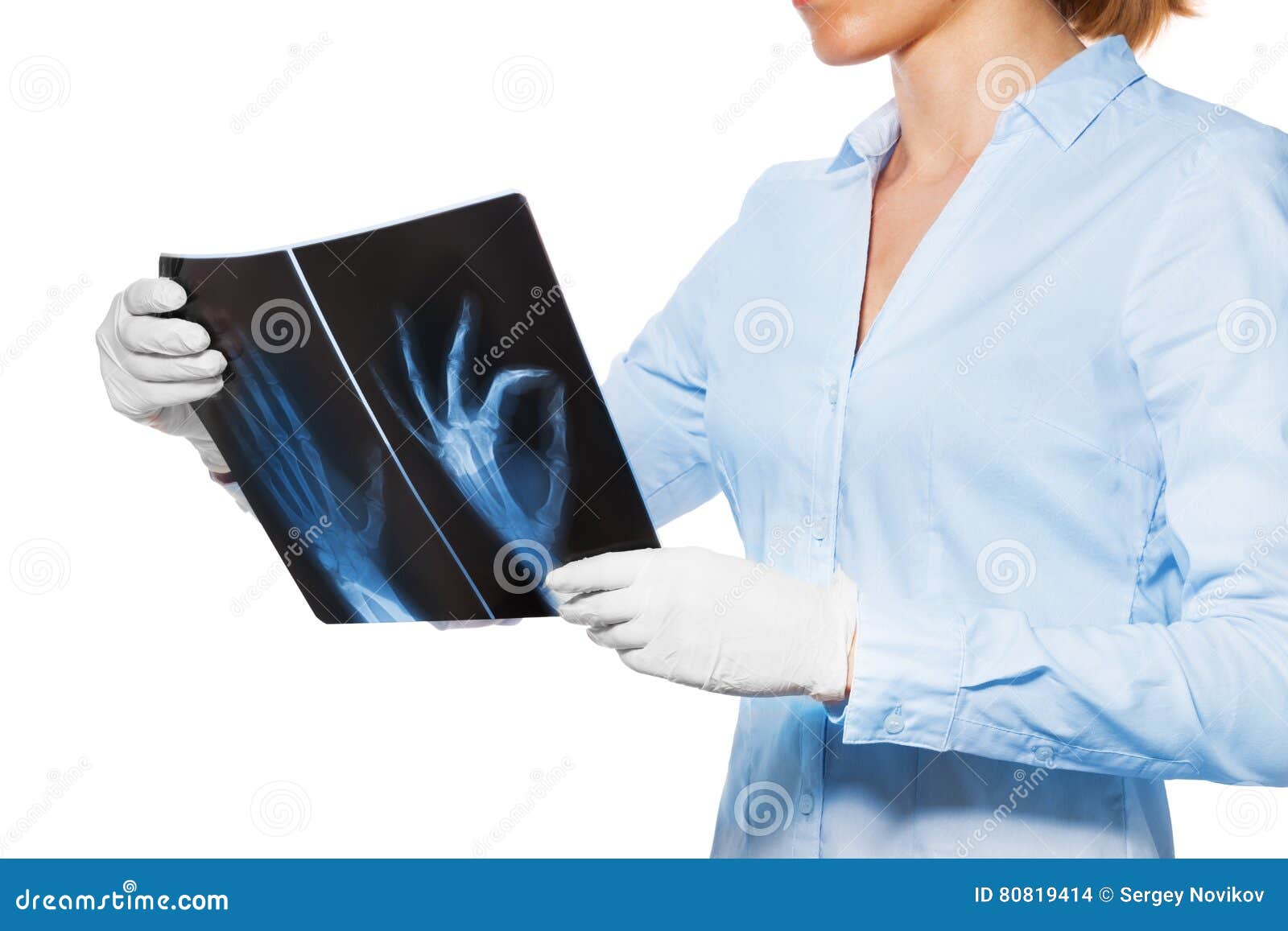 Doctor with Xray of Patient Hand and Fingers Stock Photo Image of