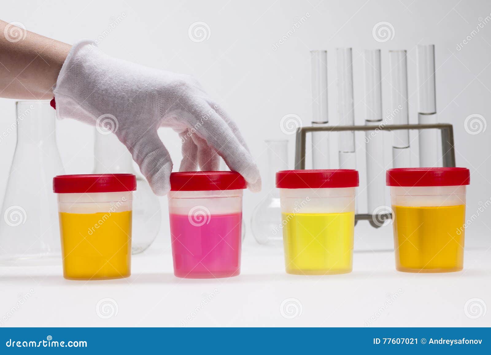 Doping Test of Urine on Laboratory Stock Image - Image of honesty