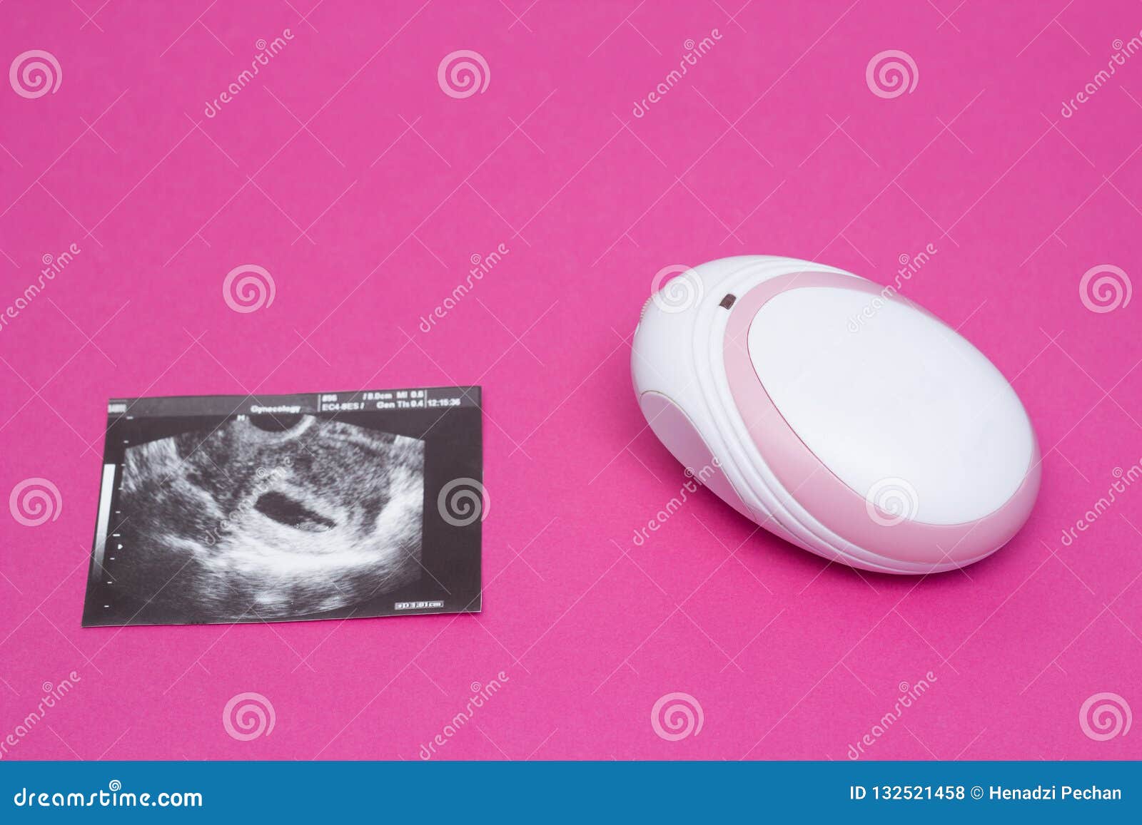 Doppler Fetal Para Escuchar En Un Latido Del Corazón De La Mujer Embarazada  De Un Niño Y De Una Imagen De Un Ultrasonido Del Emba Foto de archivo -  Imagen de escuche