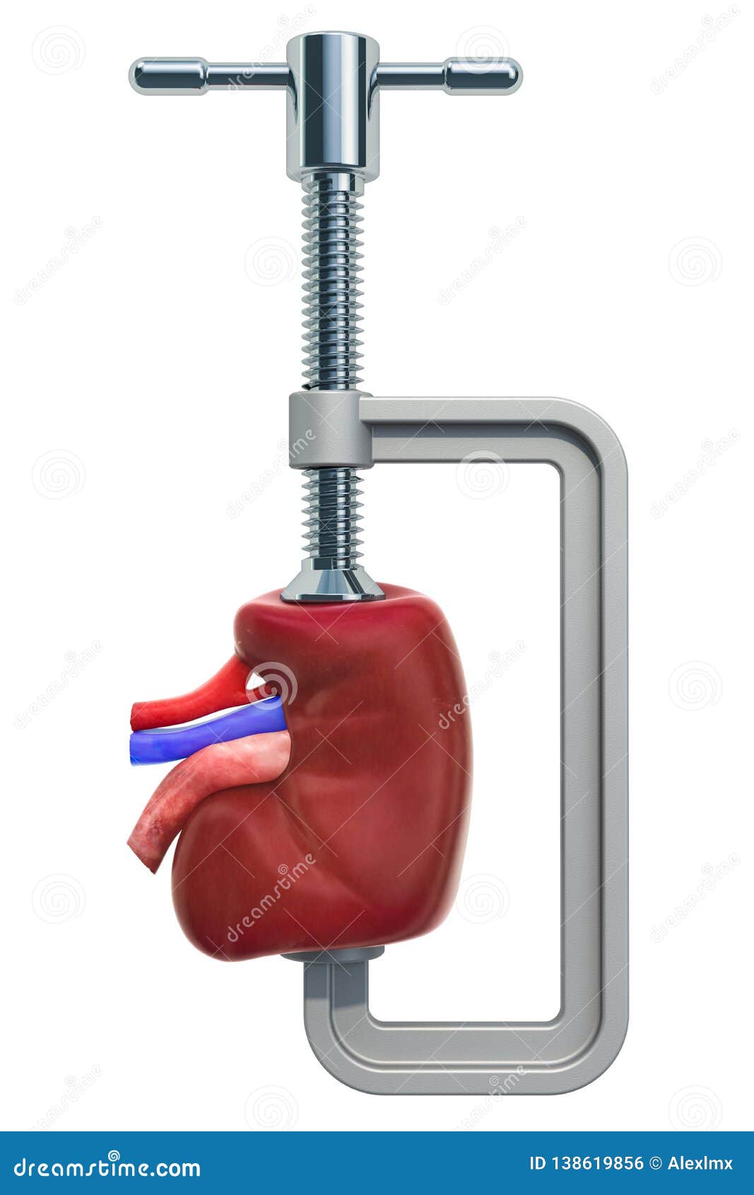 Foto de Conceito De Cirurgia De Rim 3d Renderização Isolado No