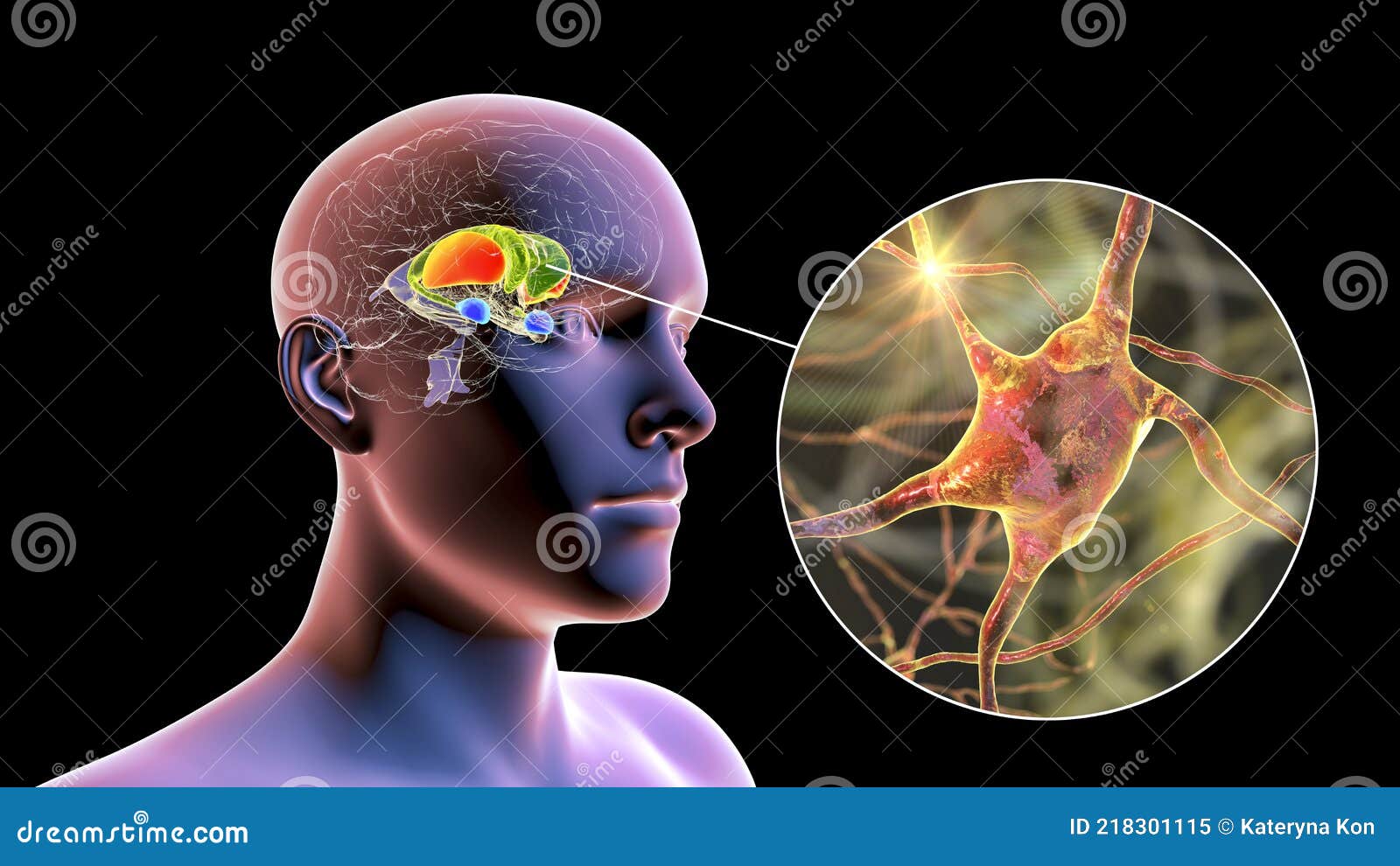 dorsal striatum in the brain and closeup view of its neurons