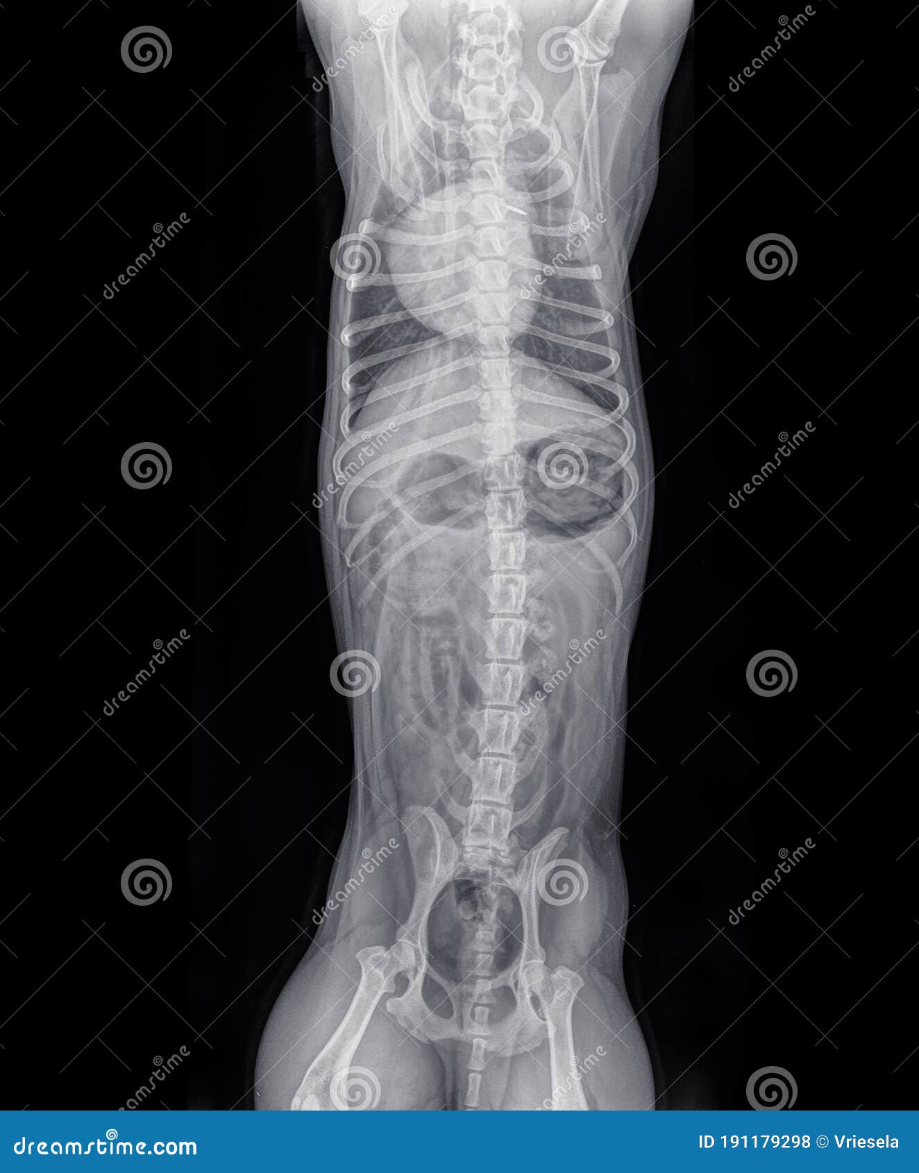 Dorso Ventral Xray Of The Thorax And Abdomen Of A Cat Stock Photo
